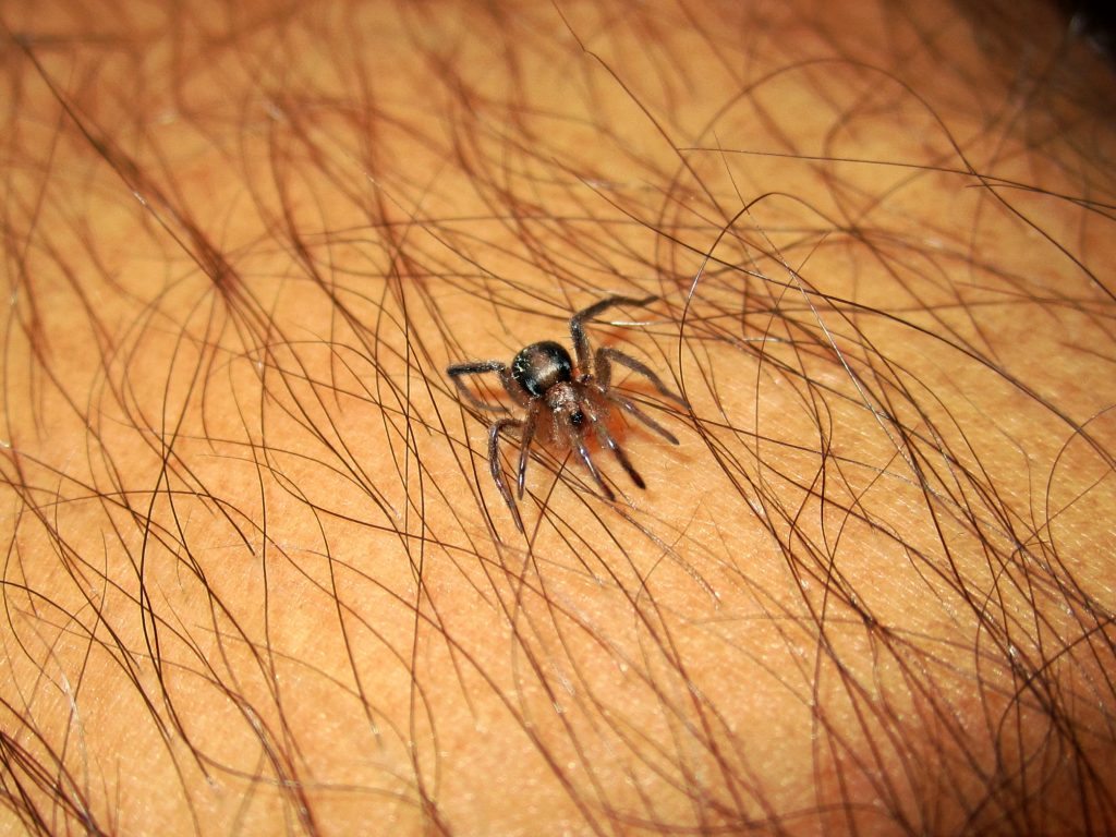 How to Treat Spider Bites