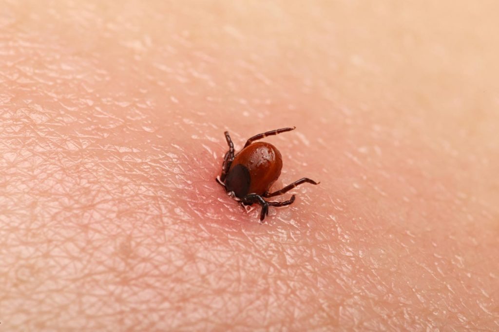 Tick Bite Treatment